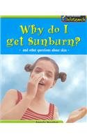 Why Do I Get a Sunburn?: And Other Questions About Skin (Body Matters)